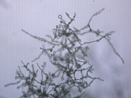 Mycélium de Phytophthora cinnamomi au microscope
